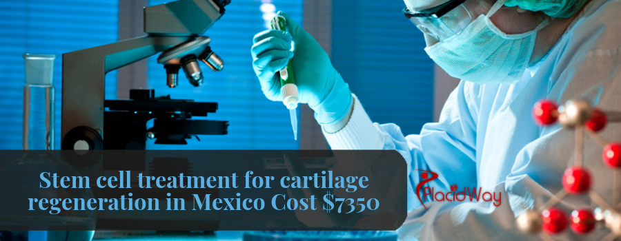 Stem cell treatment for cartilage regeneration in Mexico Cost